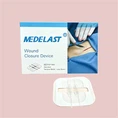 Plester Resleting